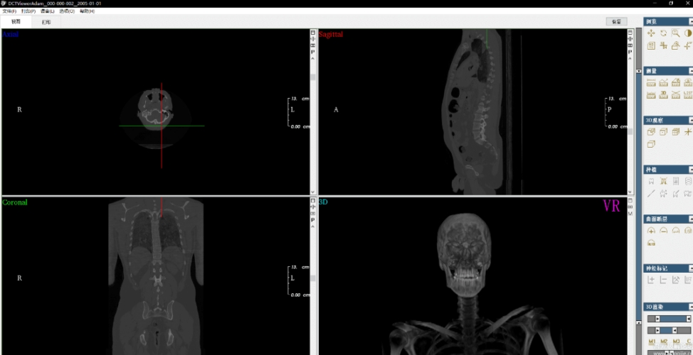 DCTViewer (CBCT查看器) v2.0.7